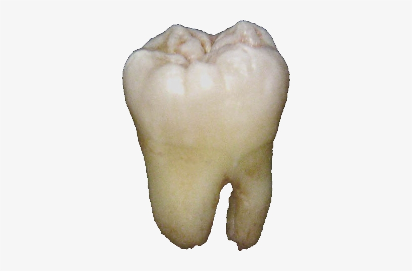 Lower Wisdom Tooth - Tooth Png, transparent png