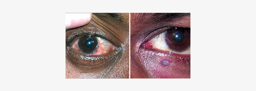 Eyes - Eye, transparent png