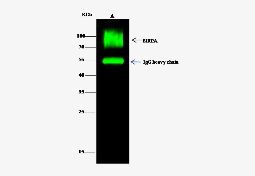 Anti-sirp Alpha Antibody Images - Signal-regulatory Protein Alpha, transparent png