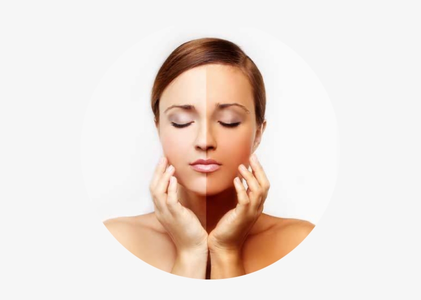 Laser Toning For Skin Lightening - Increase Melanin Production, transparent png