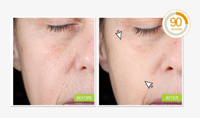 Neutratone Introductory Anti-aging Regimen Miracle - Eye Wrinkle Filler, transparent png