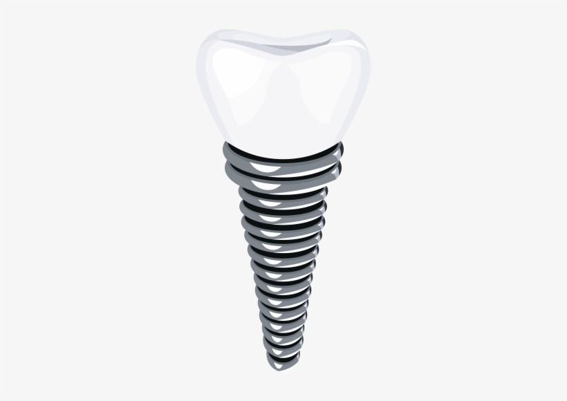 Dental Implant Png Clip Art - Implant Png, transparent png