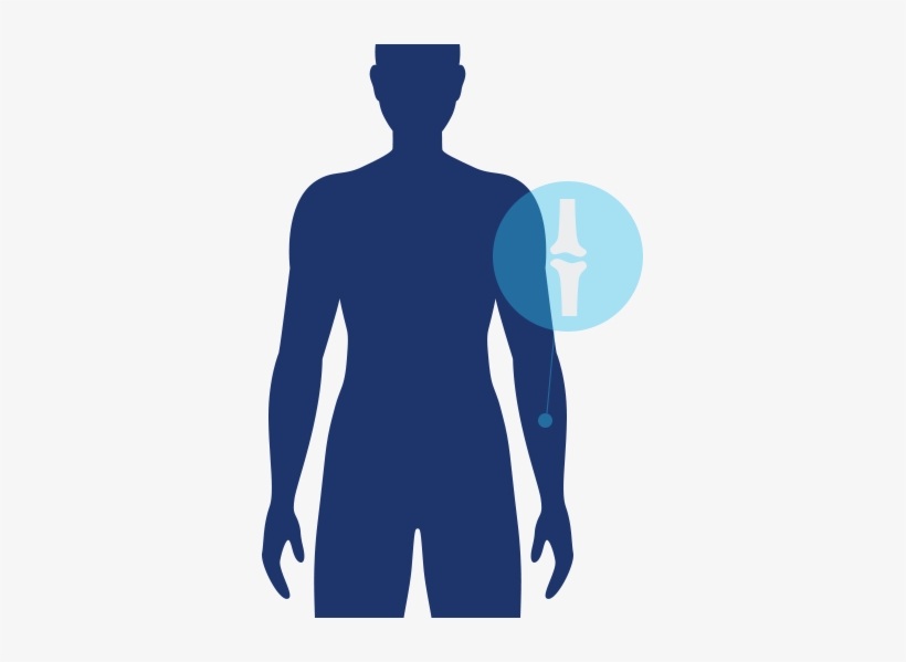 Bone Icon - Muscle Atrophy Icon, transparent png