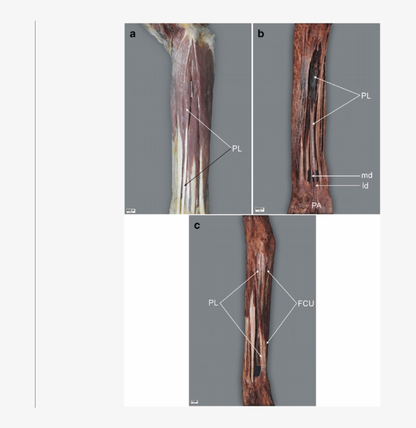 Palmaris Longus Muscle, transparent png