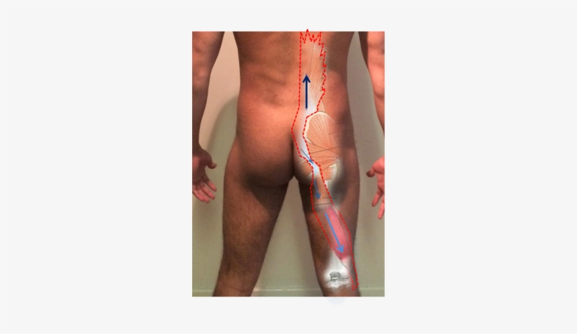 Deep Longitudinal Sling - Deep Longitudinal System, transparent png