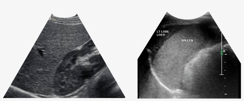 Liver And Spleen2 - Liver, transparent png