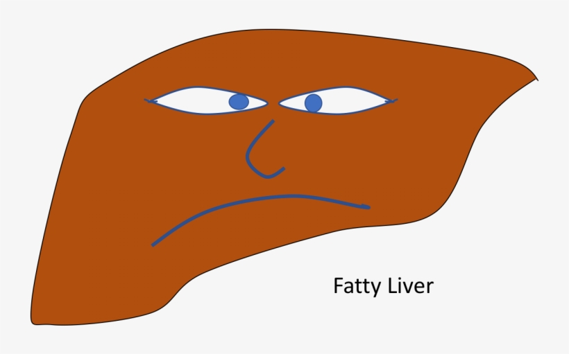 Non-alcoholic Fatty Liver Disease, transparent png