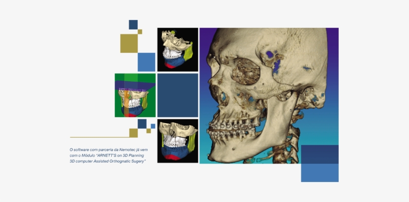 Skull, transparent png