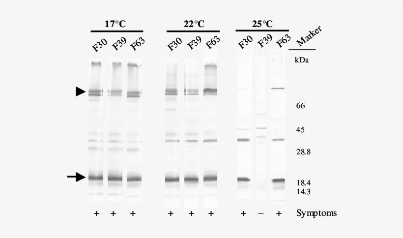 The Arrowhead Indicates The 83 Kda Readthrough Protein, - Number, transparent png
