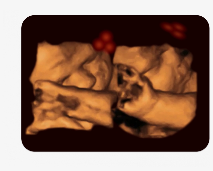 A 4-d Ultrasound Of A Fetus Tracking The Stimulus - Καλο Μηνα Μωρο, transparent png
