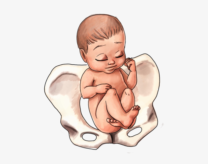 Breech Baby Position - Childbirth, transparent png