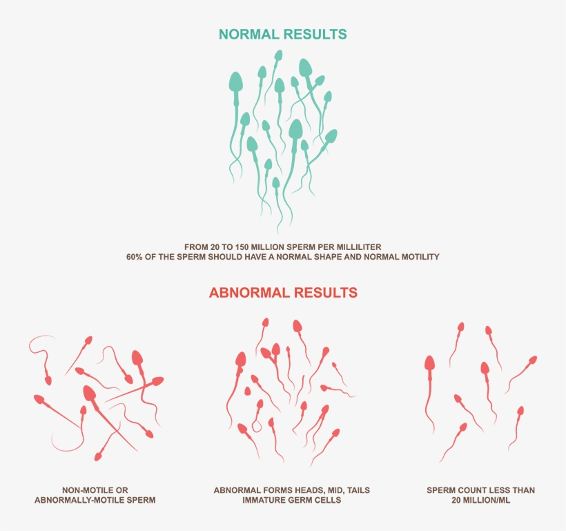 Teratospermia/ Teratozoospermia Might Perhaps Be The - 精蟲 活動 力, transparent png