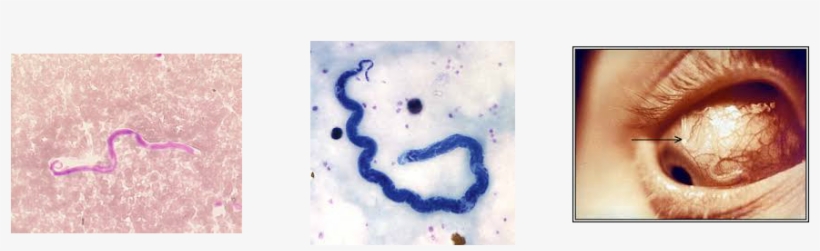 Picture - Loa Loa, transparent png