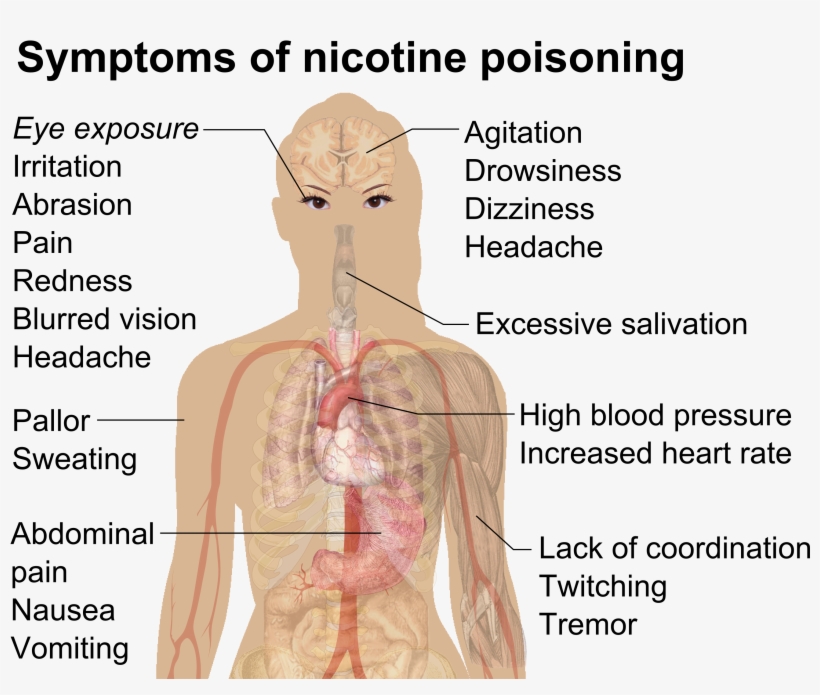 Symptoms Of Nicotine Poisoning - Nicotine Poisoning, transparent png
