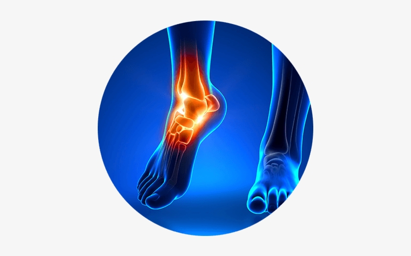 Foot & Ankle Condition - Foot And Ankle, transparent png