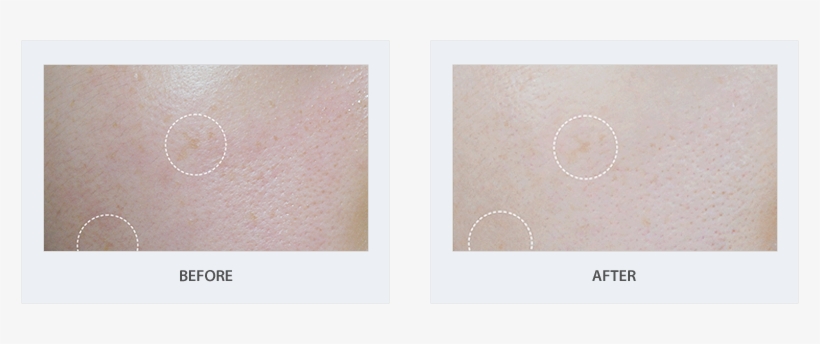 Trian Ampule - Ampoule, transparent png