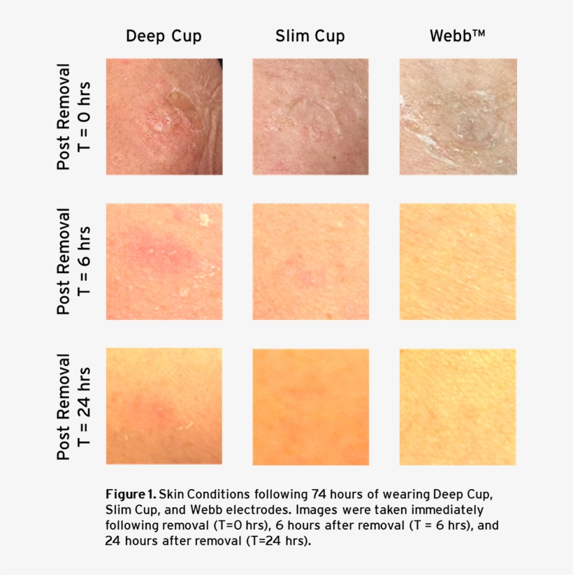 You Can See In The Picture Of Their Results, That The - Tile, transparent png