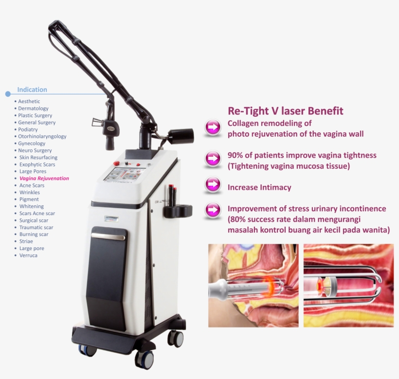 Specification - Pentagon Grand Co2 Laser, transparent png