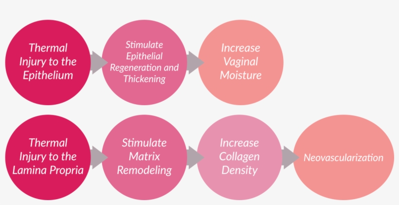 Vaginal Dryness Cure With Laser In Montreal - Montreal, transparent png
