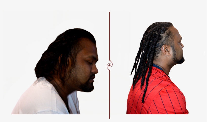 Neil Loc Extensions Before And After - Dreadlocks, transparent png