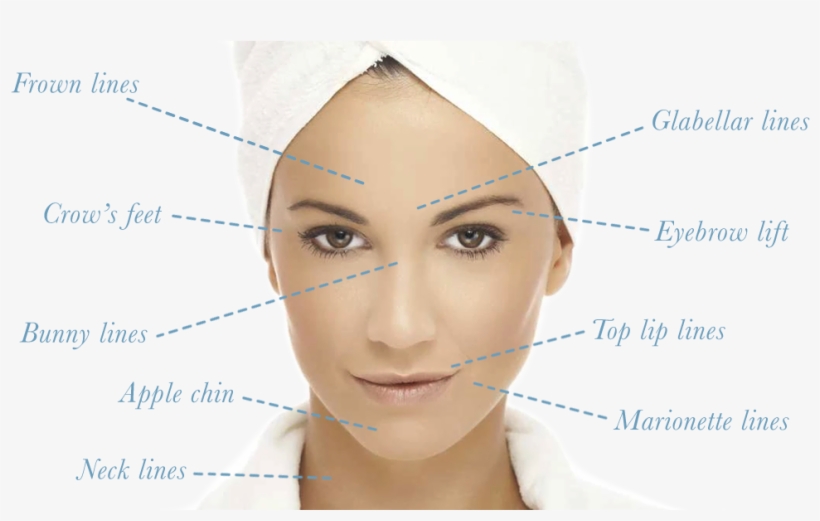 Dysport Facial Lines - Aspen Naturals Shea Butter Ivory Ultra Filtered Raw, transparent png