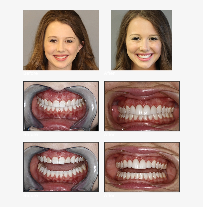 Move The Arrows On Each Image To The Left, To View - Throat, transparent png