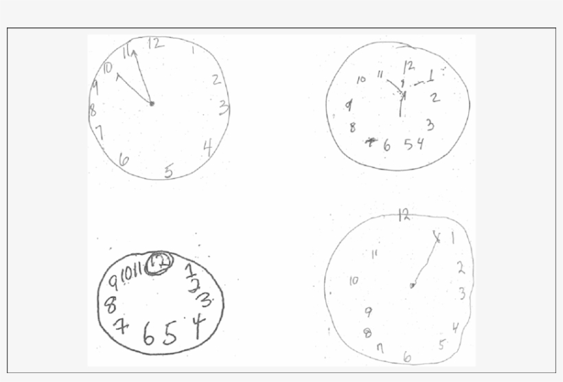 Upper Left, Concrete Error With Misplacement Of The - Circle, transparent png