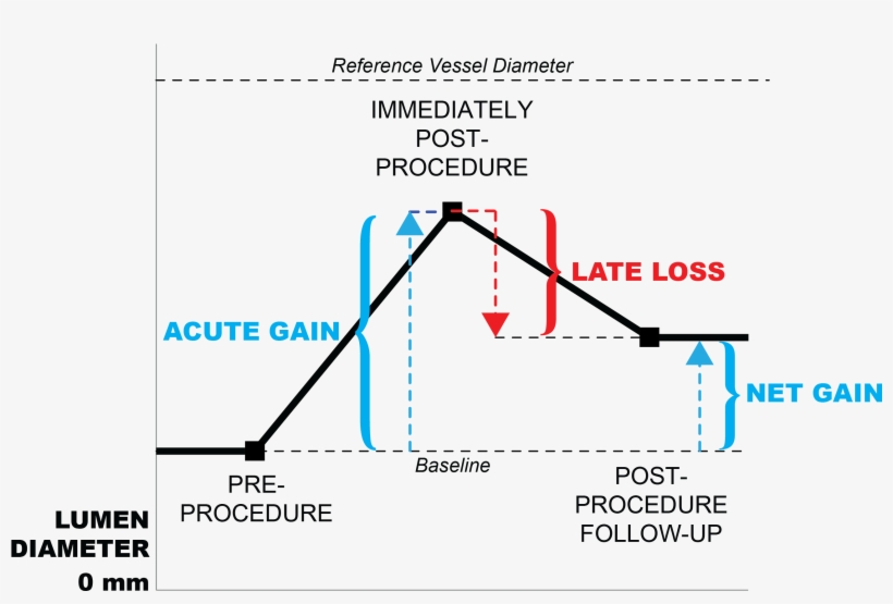 Late Loss Restenosis - June 13, transparent png
