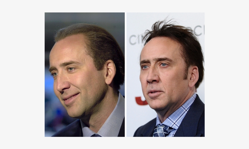Nicolas Cage 2001 Vs Celebrity Men With Hair Pieces 810x410