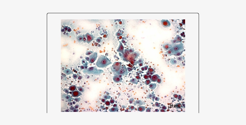 Nucleus And Nucleolus Criteria - Nucleolus, transparent png