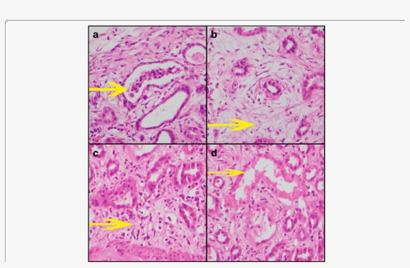 Yellow Arrow Depicts As Follows - Tubule, transparent png