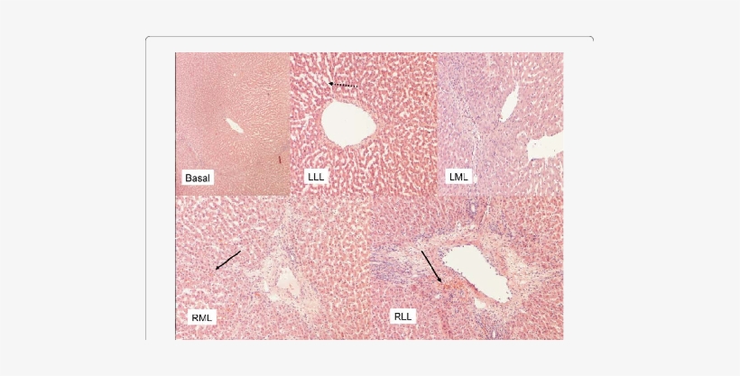 Histological Damage In Biopsy Specimens Taken After - Circle, transparent png