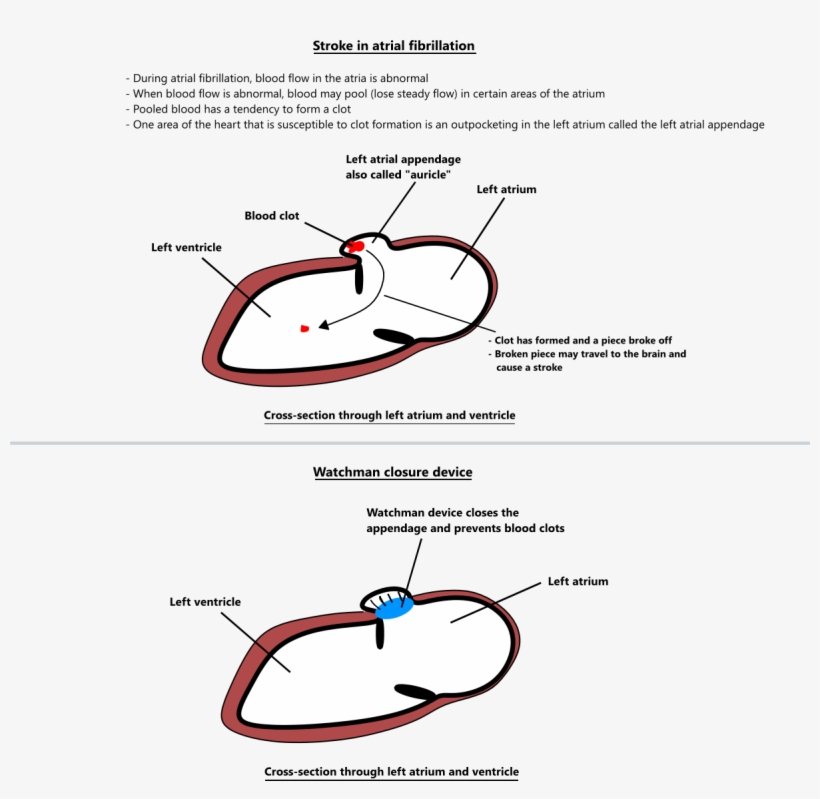Diagram, transparent png