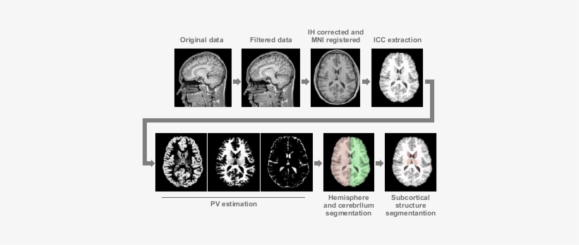 However This Time Can Vary Depending On The Number - Computed Tomography, transparent png