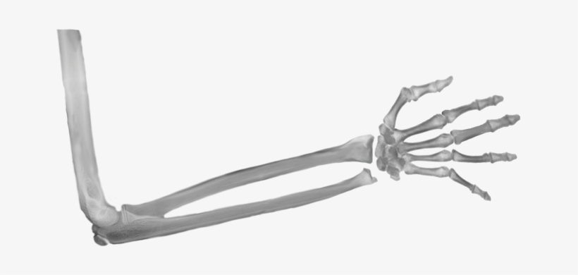 Xray Of Full Arm, transparent png