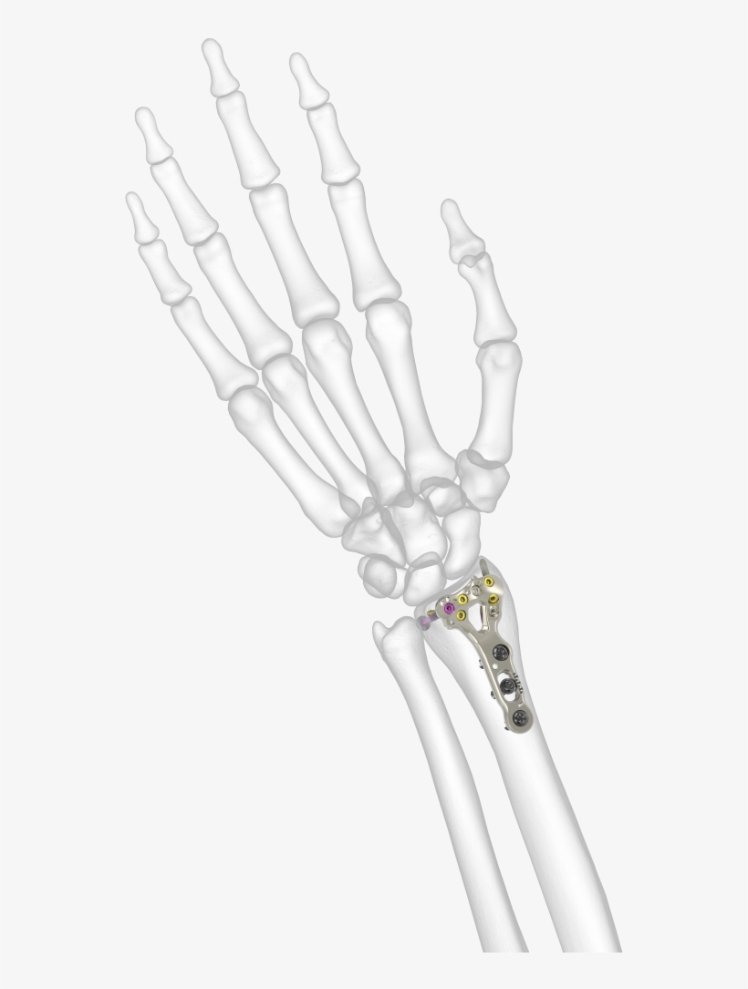 Acu Loc 2 - Skeleton Hi Res Arm, transparent png