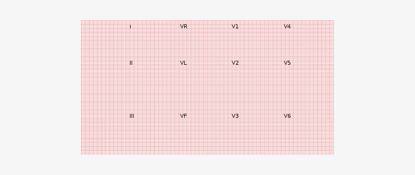 This Image Rendered As Png In Other Widths - Blank Ecg Paper, transparent png