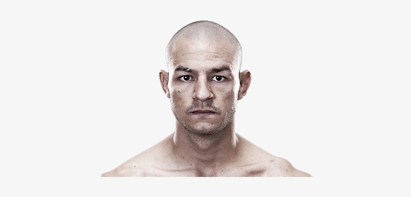 Not Bald, Bald, But Receded Hairline And Crown Is Thin - Jim Miller, transparent png