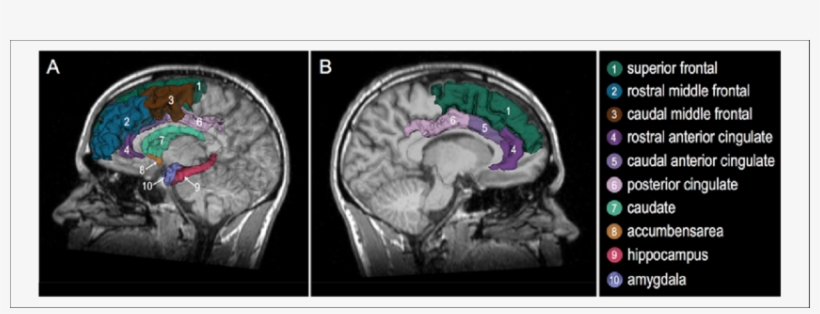 3-d Model Of The Human Brain Superimposed On The Mri - Human Brain, transparent png