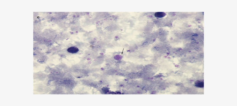 (b) (c) - Ceiling, transparent png