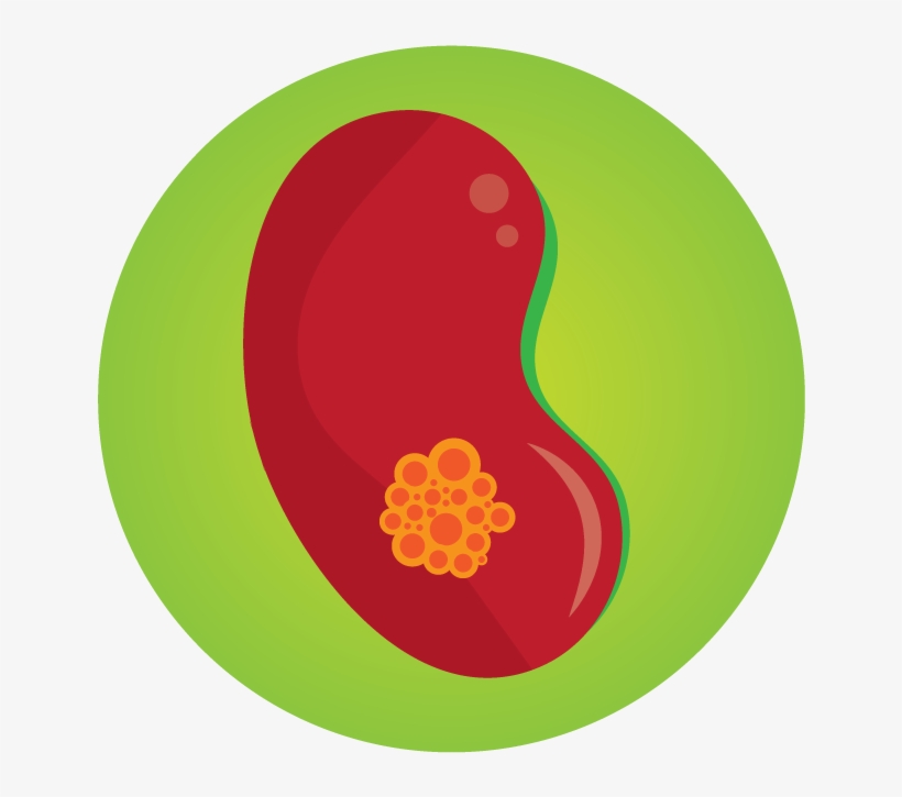 Kidney Injury - Circle, transparent png