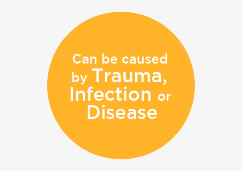 What Is A Spinal Cord Injury - Music Director, transparent png