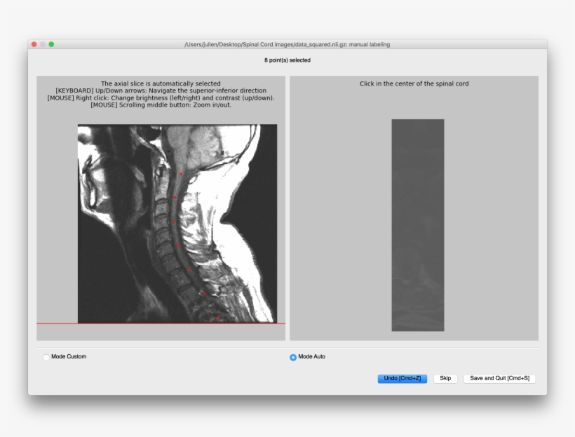 Results - Computed Tomography, transparent png