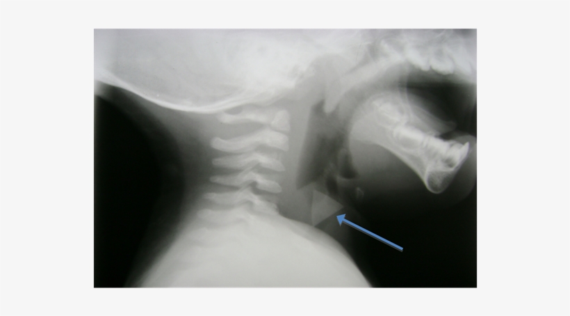 Medical Radiography, transparent png