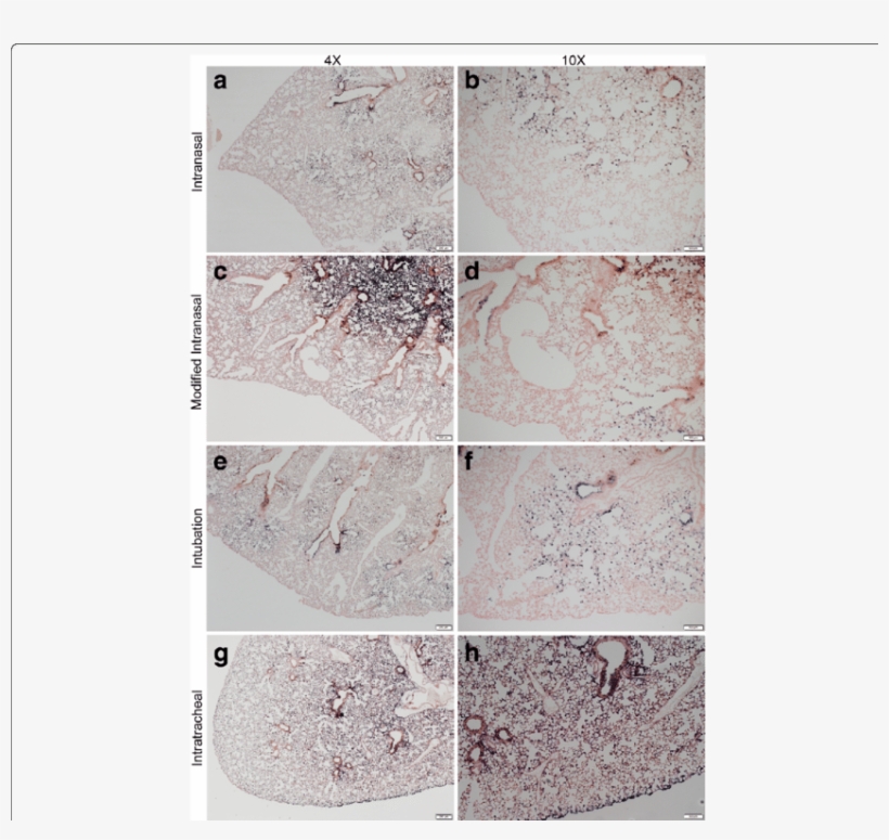 Histological Analysis Of Alkaline Phosphatase Staining - Alkaline Phosphatase, transparent png