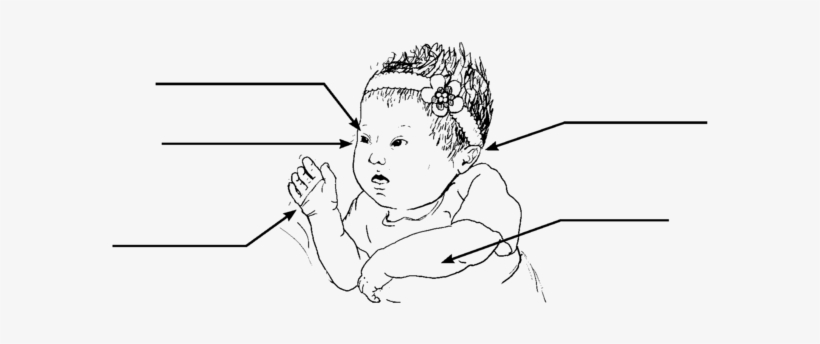Free Photo Of Black Child With Down Syndrome Png - Mãos De Recem Nascido Com Síndrome De Down, transparent png