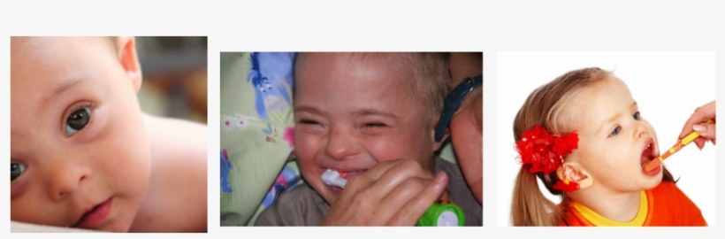 Periodontics And Down Syndrome - Toddler, transparent png