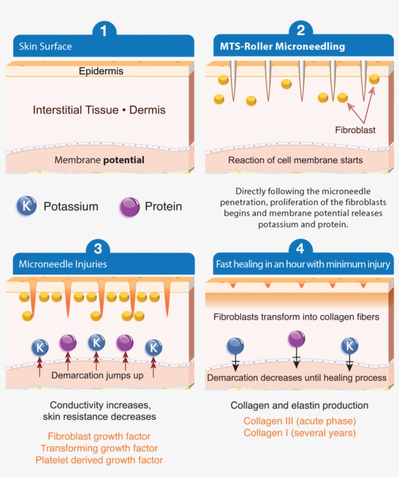 The Downtime Required Of Various Skin Therapies Depends - Skin, transparent png
