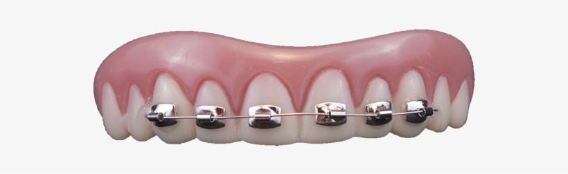 10112 Fool-all Brace - Braces For False Teeth, transparent png