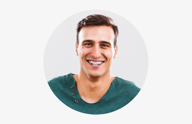 Metal Braces - Adult Braces, transparent png